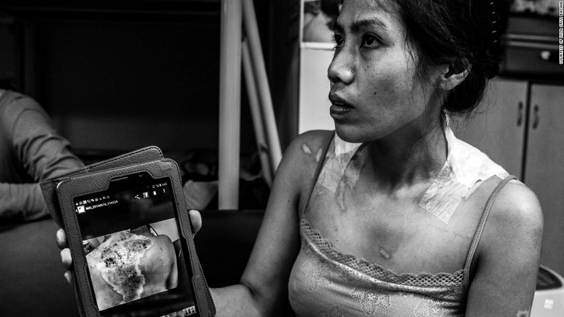 Filipina Maid Shows A Picture Is Worth A Thousand Words – Cancer Incytes
